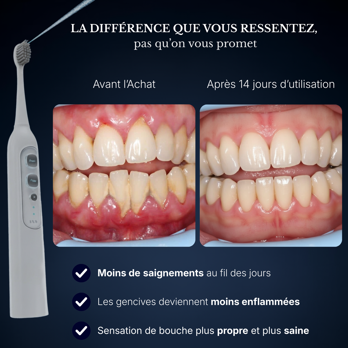 NOVA ‭Ⅰ - Brosse 2-en-1