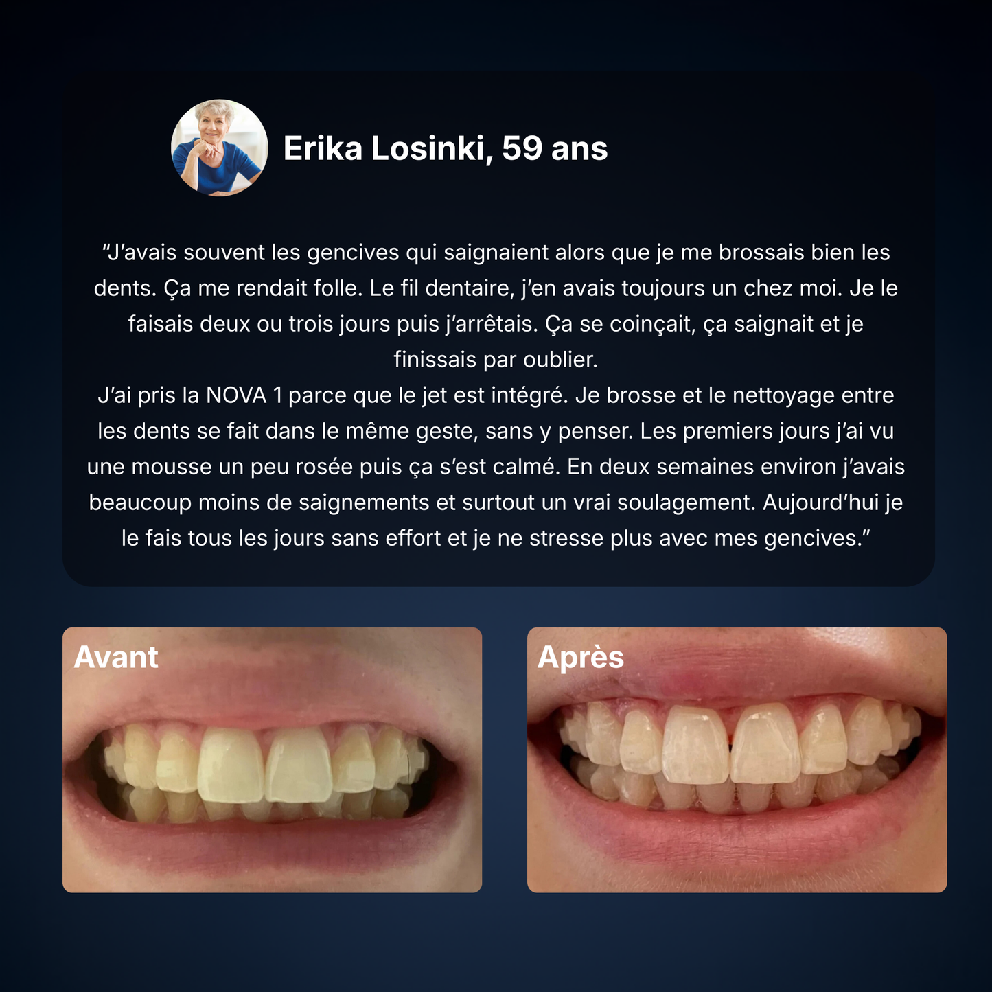 NOVA ‭Ⅰ - Brosse 2-en-1