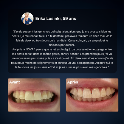 NOVA ‭Ⅰ - Brosse 2-en-1